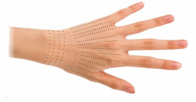 Injection points for hands during bioresuscitation