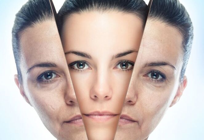 The process of eliminating facial skin from age-related changes